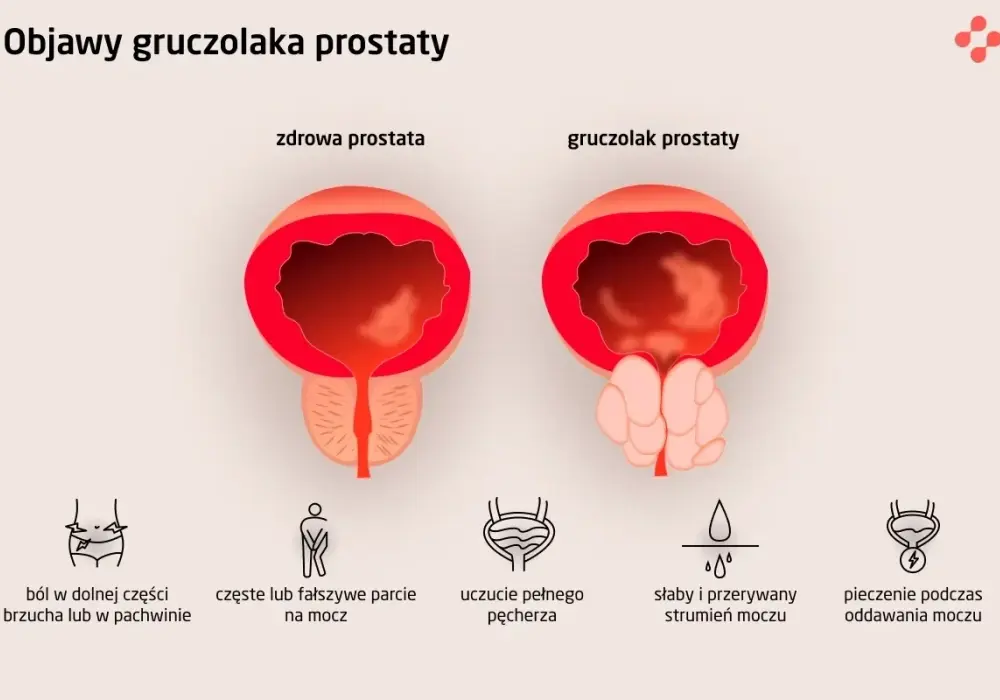 Pies dziwnie siusia? To może być prostata! Poradnik