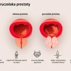 Pies dziwnie siusia? To może być prostata! Poradnik