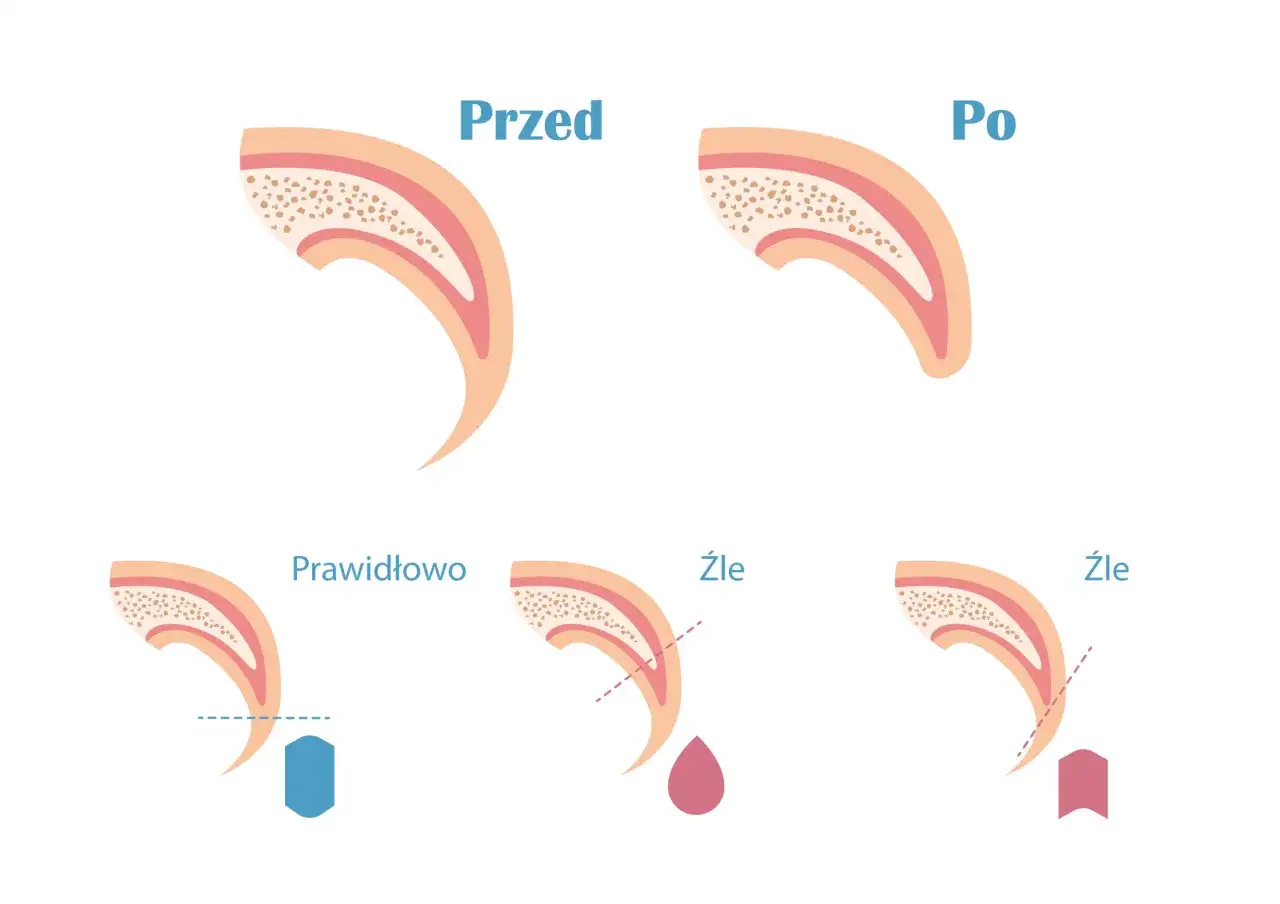 anatomia pazura psa schemat